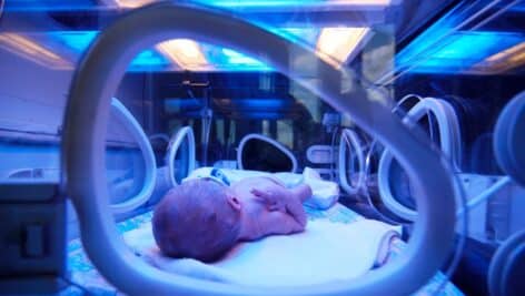 Premature baby in an incubator