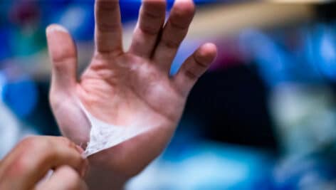 A hand peeling a soy bandage.