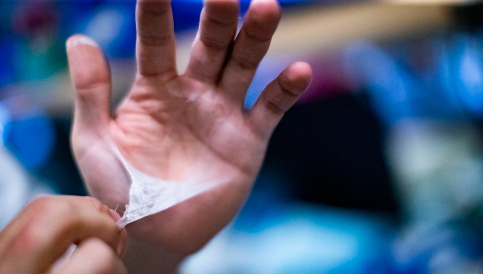 A hand peeling a soy bandage.