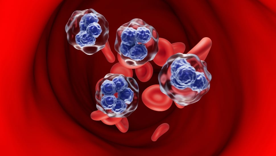 T-cell lymphoma cells in the blood flow.
